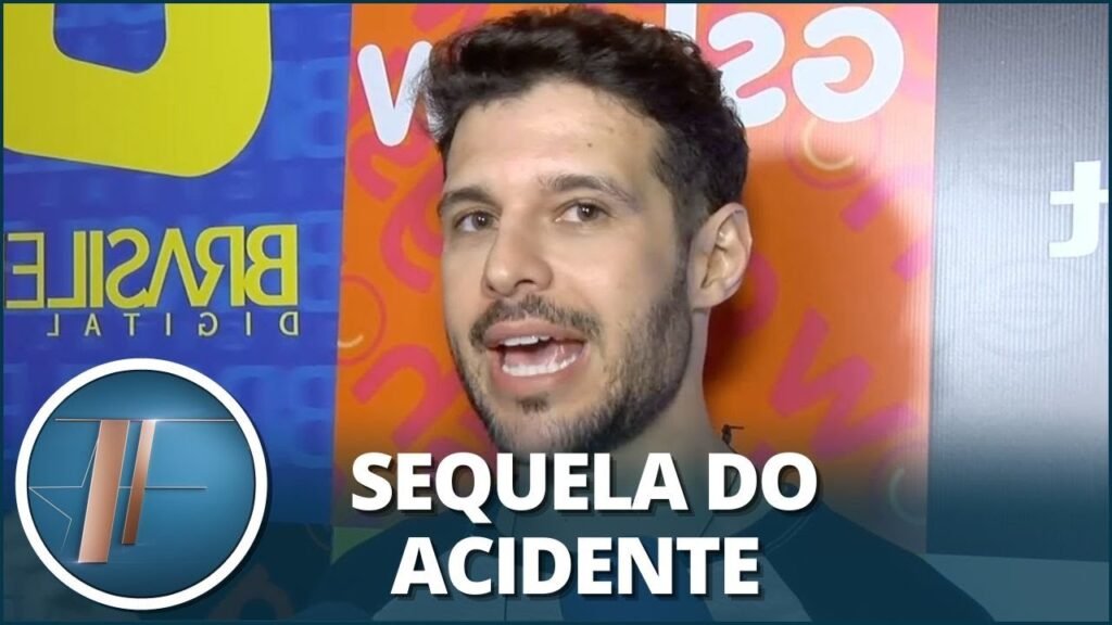 Rodrigo Mussi revela mudança na voz após acidente: “Está um pouquinho mais grossa”